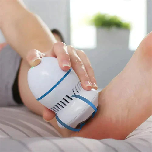 Lime Électrique pour Pieds – Enlève Callosités et Peau Morte en Douceur