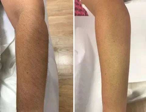 SoftSilk™ – Peau lisse longue durée et sensation de sécurité [50 % de réduction]