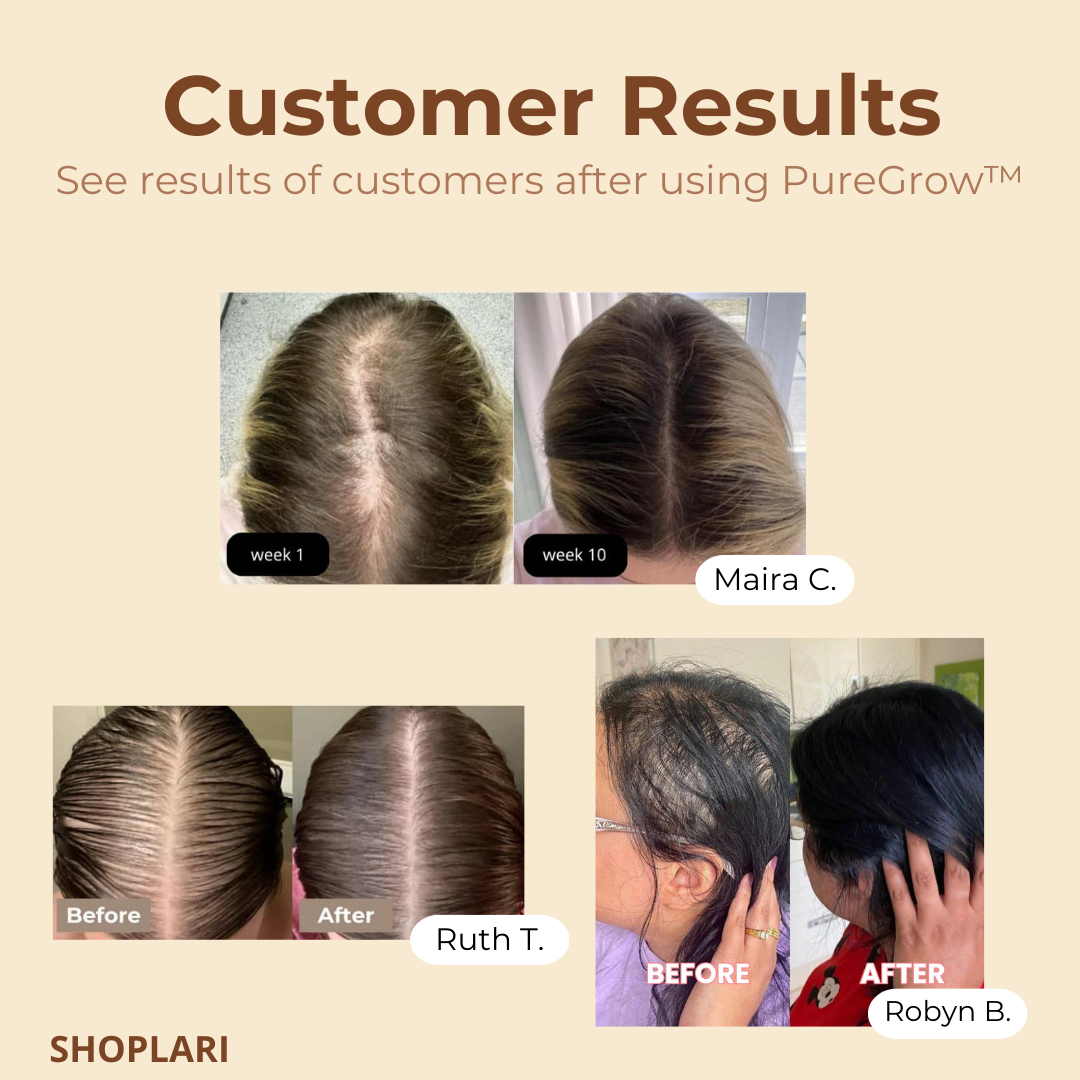 PureGrow™ – Soin intensif du cuir chevelu pour des cheveux en pleine santé [50 % de réduction]