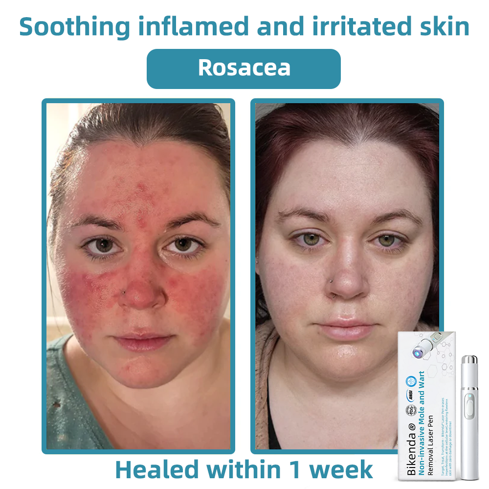 LumiRaze™ – Élimine Rapidement les Imperfections Cutanées et Apporte une Confiance Éclatante [50 % de Réduction]