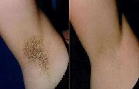 SoftSilk™ – Peau lisse longue durée et sensation de sécurité [50 % de réduction]