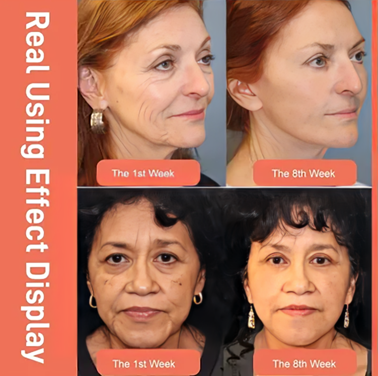 Crème Anti-Âge Visage au Rétinol et Acide Hyaluronique – Peau Lisse et Hydratée