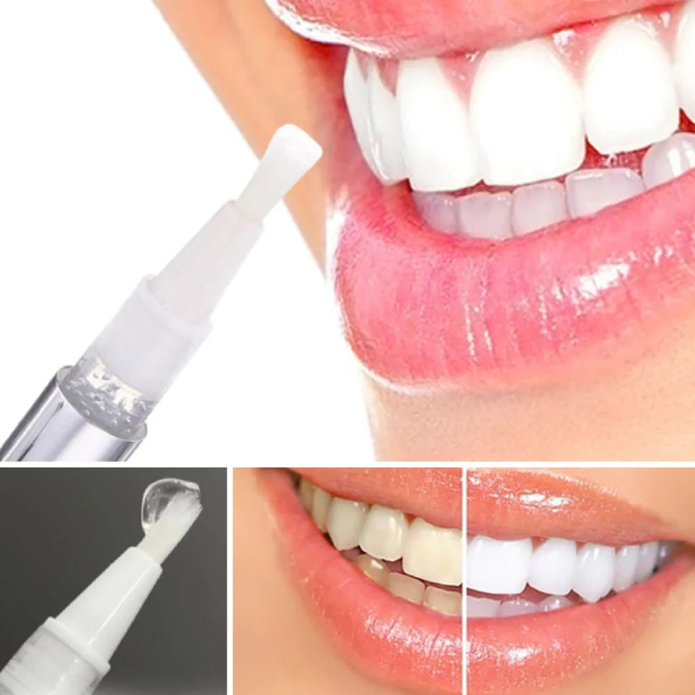 WhiteBoost™ – Rayonnez avec un Sourire qui Illumine Toute la Pièce [1 + 1 Gratuit]