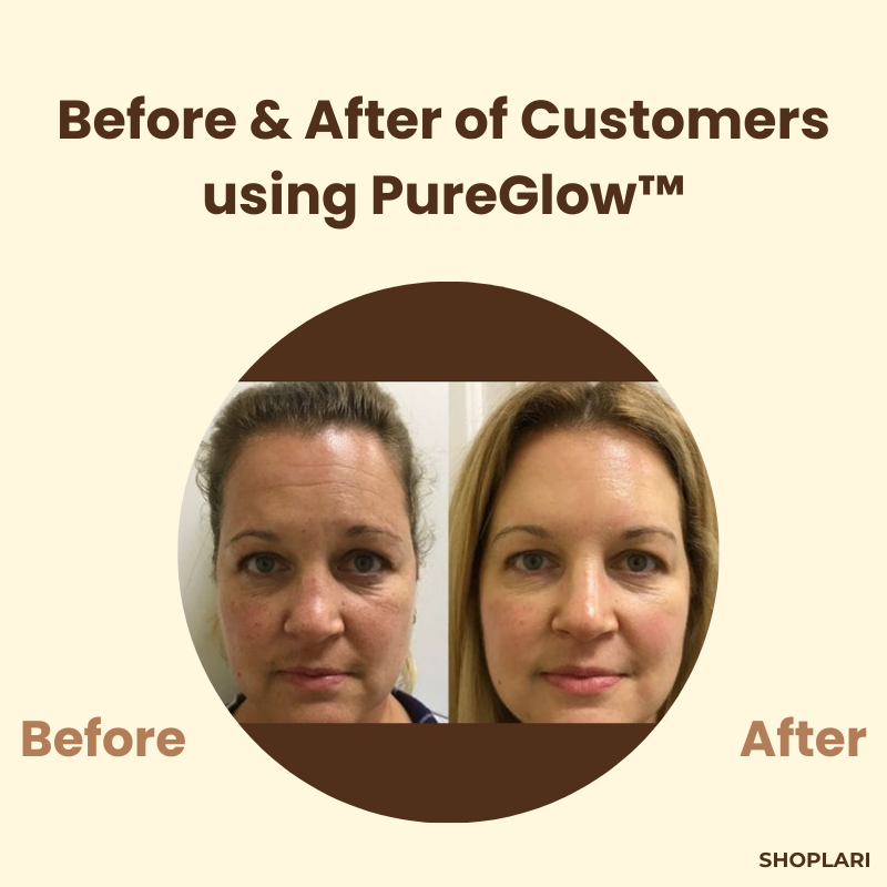 PureGlow™ – Peau claire et jeune qui inspire confiance [1 + 1 Gratuit]