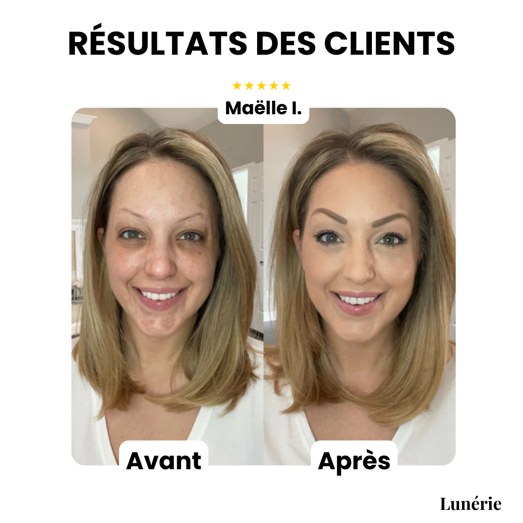 DewCream™ – Soin Éclaircissant à la Couvrance Lumineuse [50 % de Réduction]