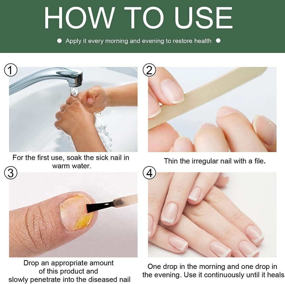 Sérum Réparateur pour Ongles Abîmés et Mycoses – Soin Quotidien