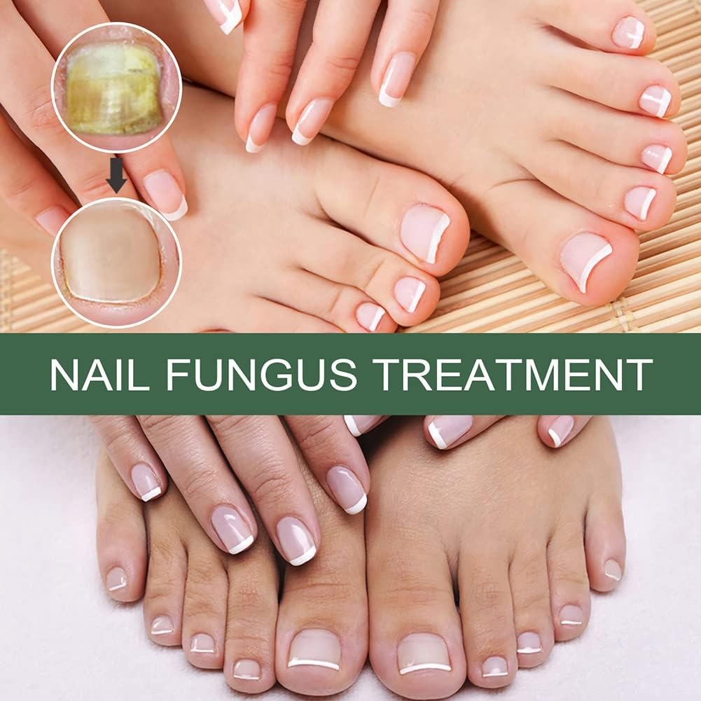Sérum Réparateur pour Ongles Abîmés et Mycoses – Soin Quotidien