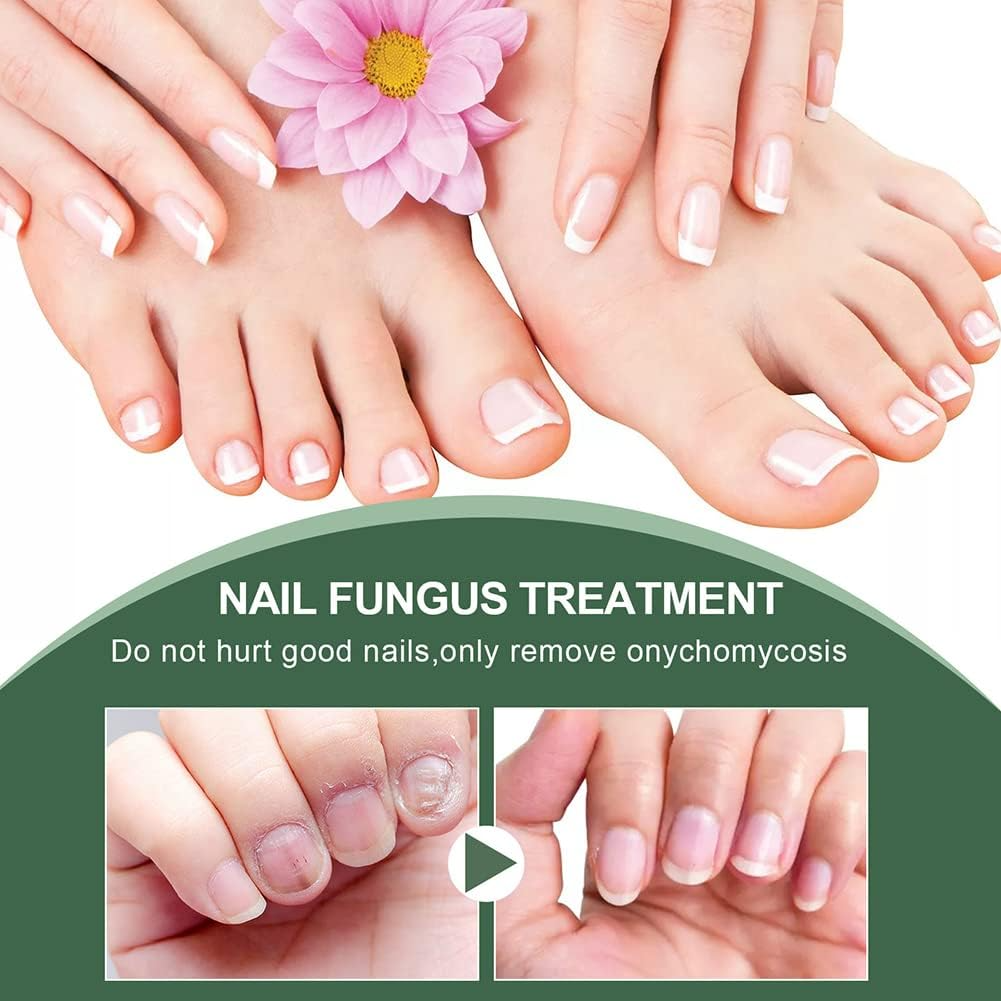 Sérum Soin des Ongles Fortifiant pour Ongles Cassants et Décolorés
