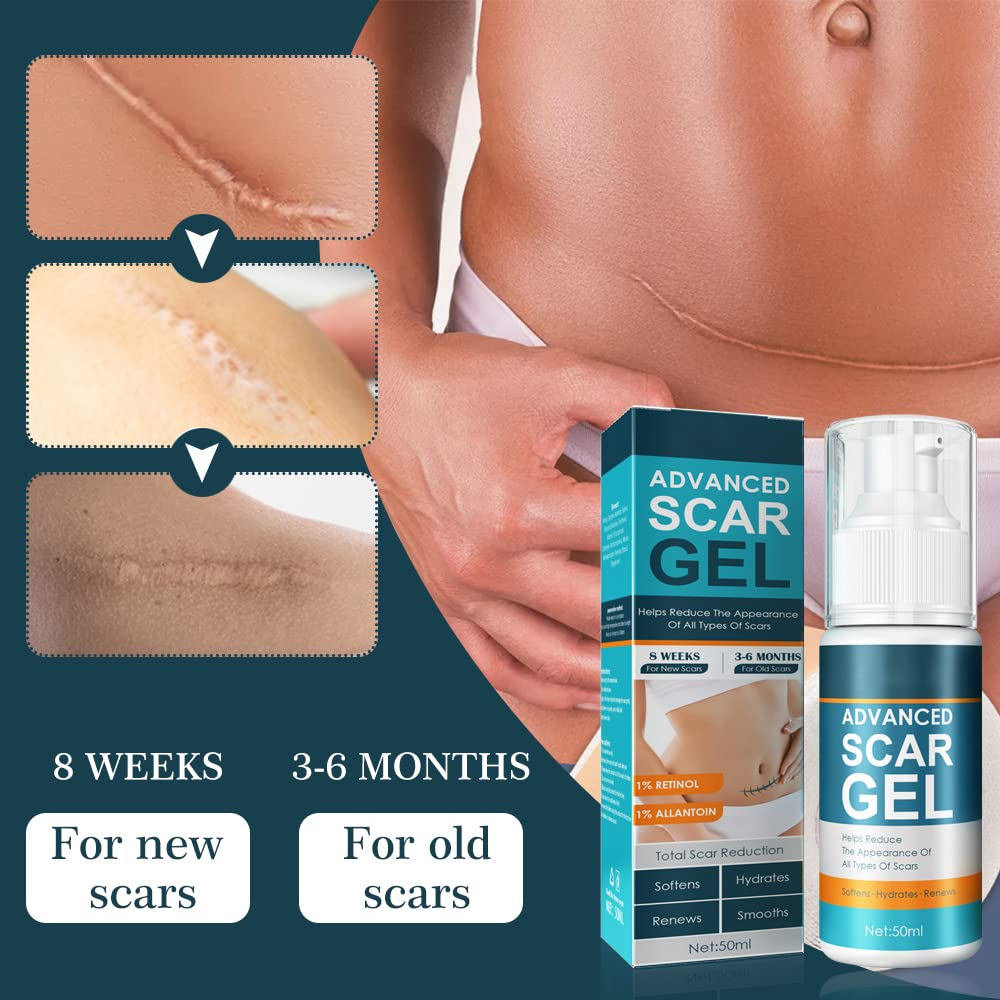 ScarRelief™ – Apaiser, guérir et renouveler en douceur [1 + 1 Gratuit]