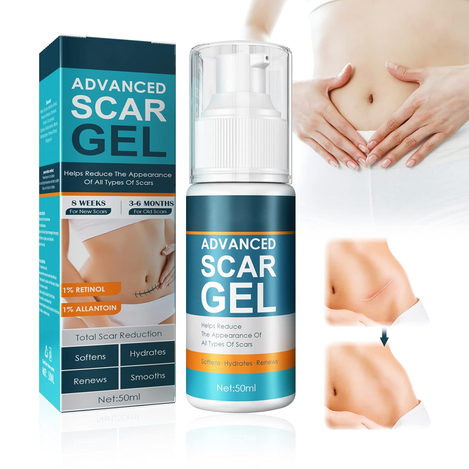 ScarRelief™ – Apaiser, guérir et renouveler en douceur [1 + 1 Gratuit]