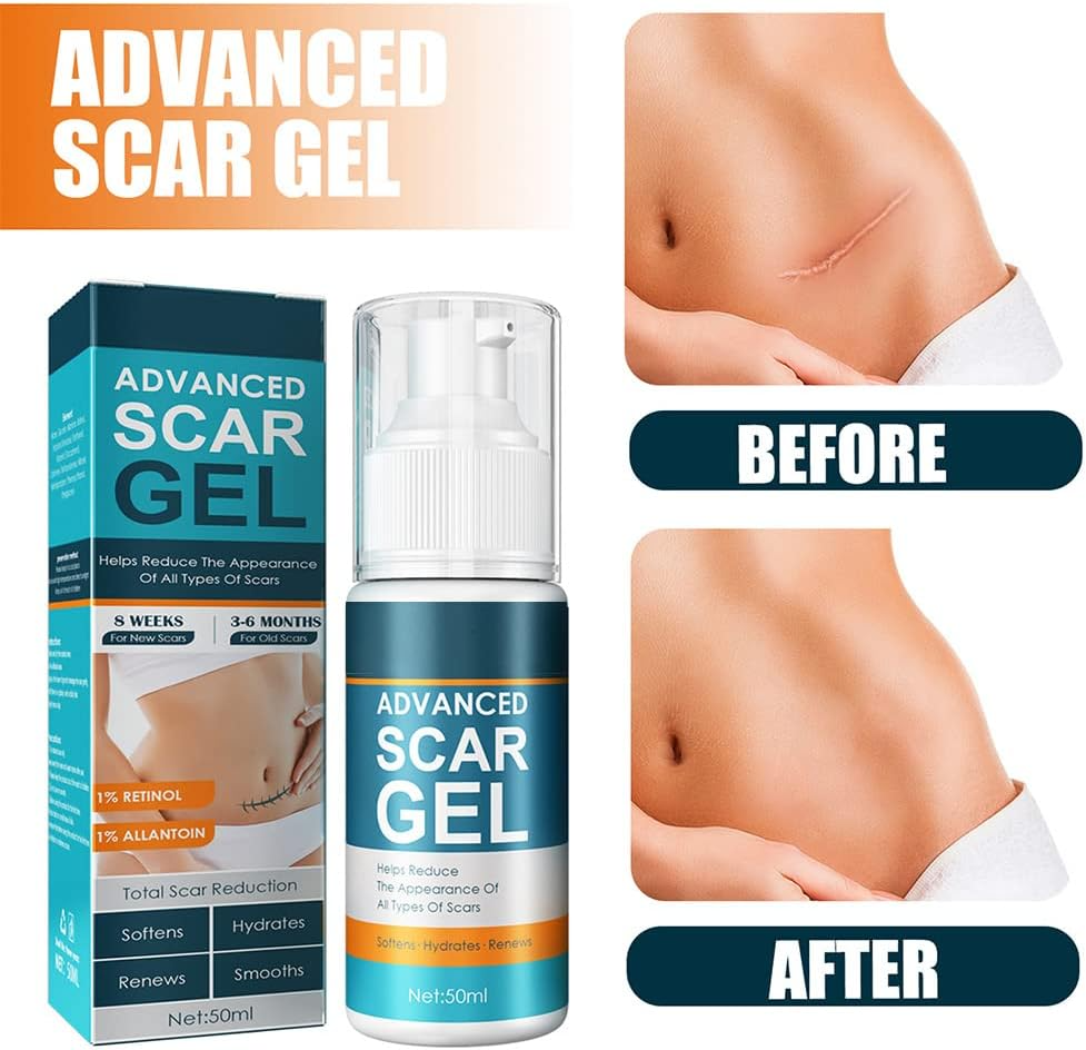 ScarRelief™ – Apaiser, guérir et renouveler en douceur [1 + 1 Gratuit]