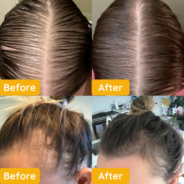 Jairy™ - Huile essentielle pour la pousse des cheveux [1 + 1 Gratuit]