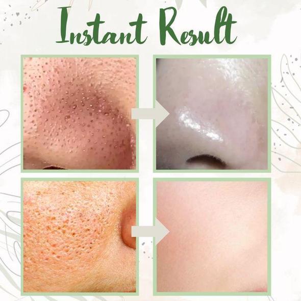Stick Masque au Thé Vert Nettoyant en Profondeur pour Pores Purs