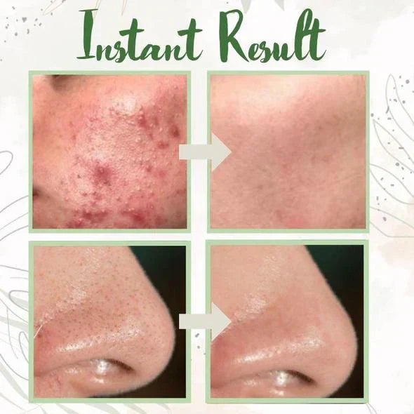 Stick Masque au Thé Vert Nettoyant en Profondeur pour Pores Purs