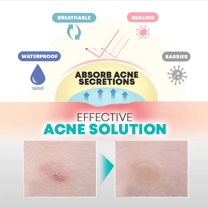 Pansements Anti-Acné à l'Hydrocolloïde et Acide Salicylique pour Peau Nette