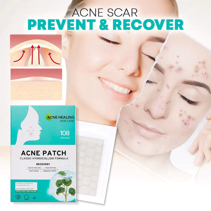 Pansements Anti-Acné à l'Hydrocolloïde et Acide Salicylique pour Peau Nette