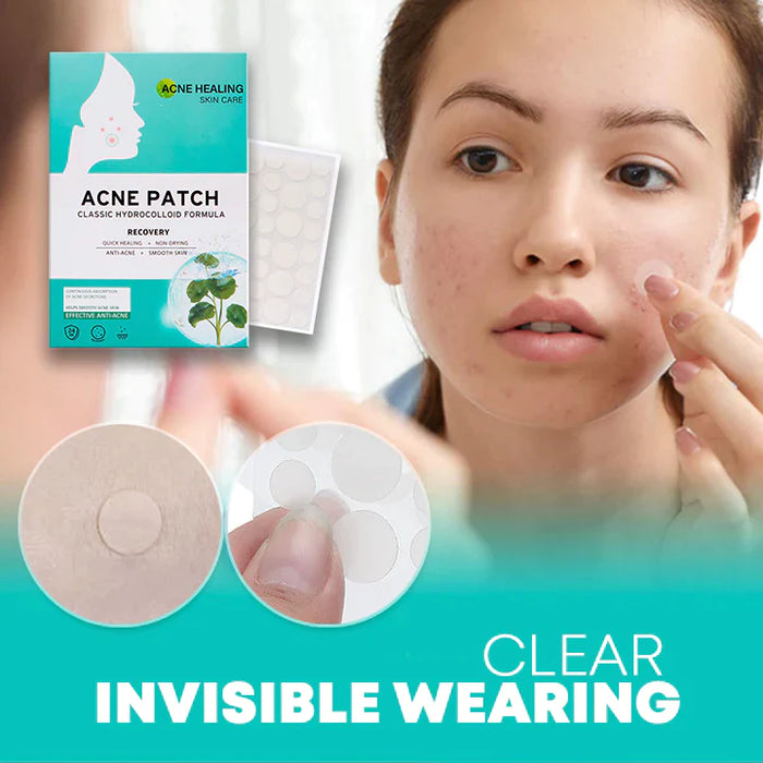 Pansements Anti-Acné à l'Hydrocolloïde et Acide Salicylique pour Peau Nette