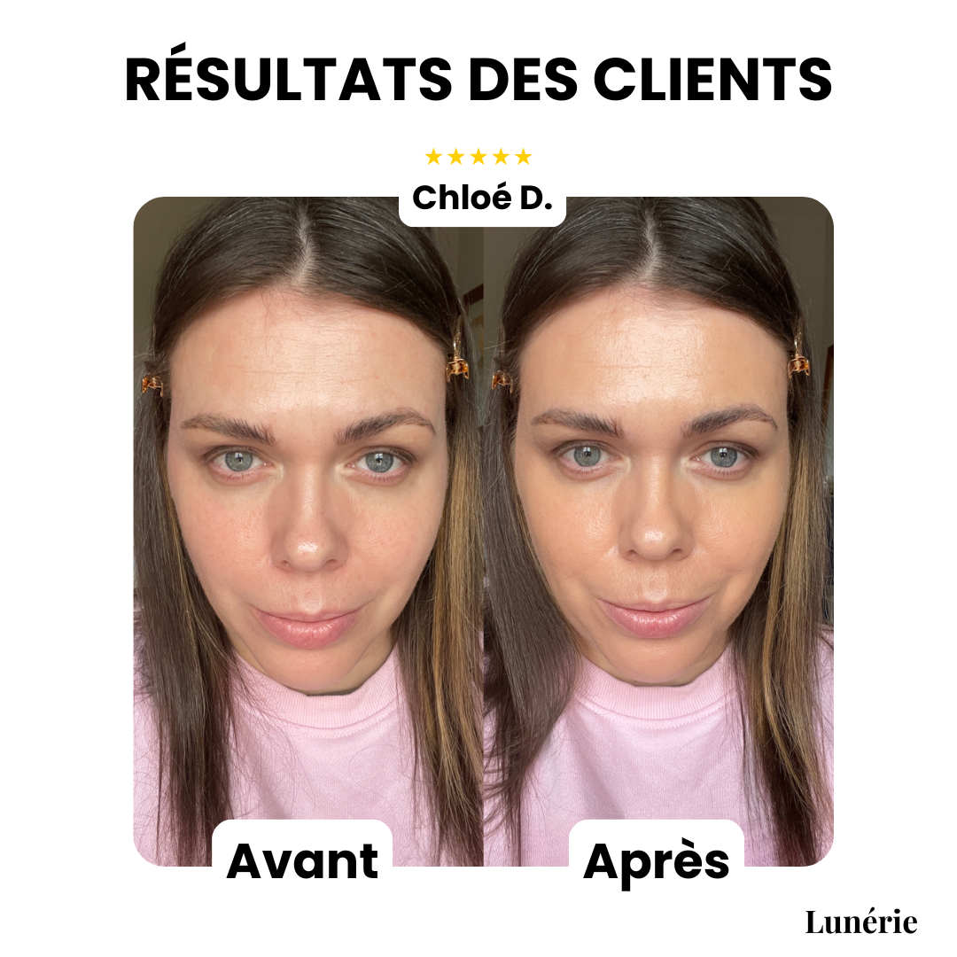 DewCream™ – Soin Éclaircissant à la Couvrance Lumineuse [50 % de Réduction]
