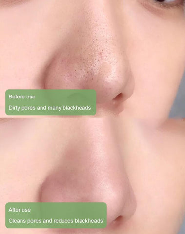 Stick Masque au Thé Vert Nettoyant en Profondeur pour Pores Purs