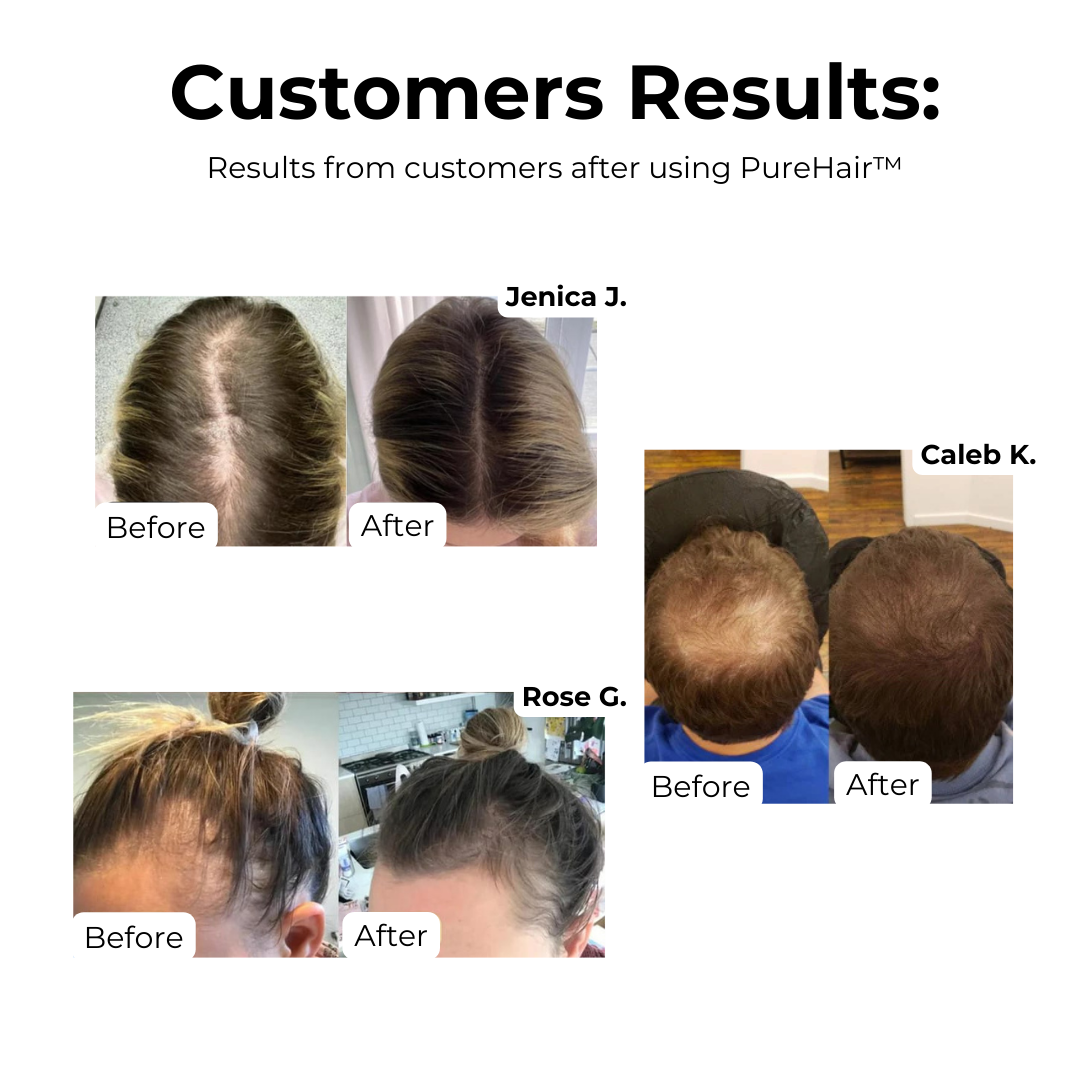 Huile capillaire naturelle pour la croissance et le renforcement des cheveux