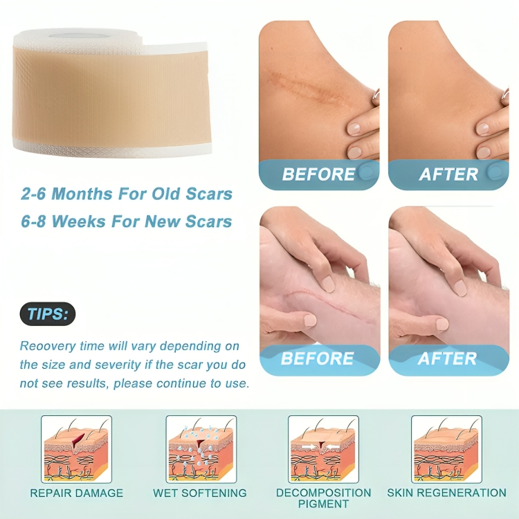 Dermiva™ – Bandes en silicone pour cicatrices efficaces [1 + 1 Gratuit]