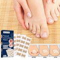 Coussinets Correcteurs pour Ongles Incarnés – Soin et Confort des Pieds