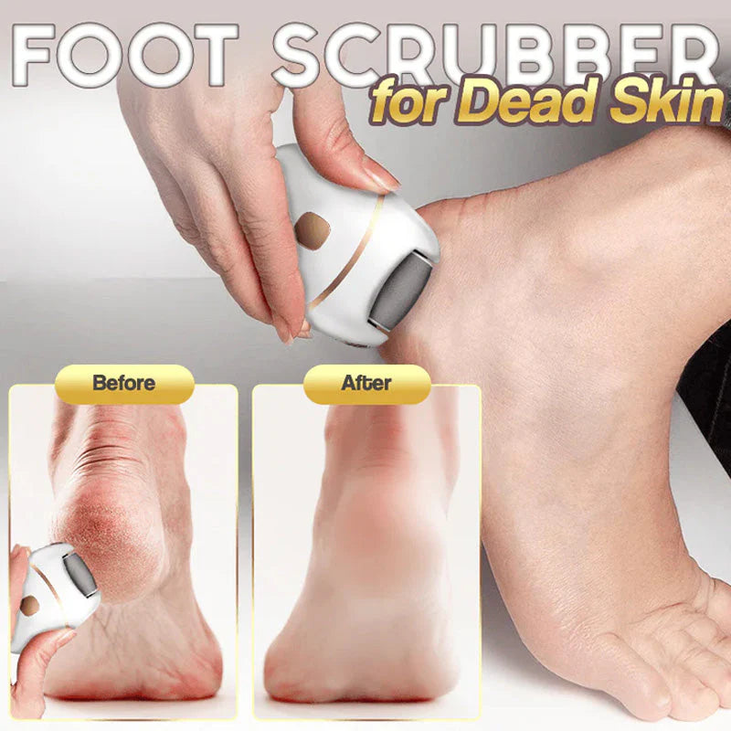 Gleam™ – Élimination douce des callosités pour des pieds lisses et soyeux [50 % de réduction]