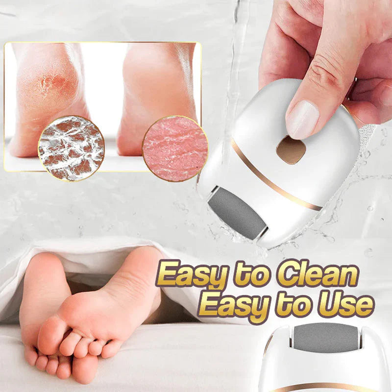 Gleam™ – Élimination douce des callosités pour des pieds lisses et soyeux [50 % de réduction]