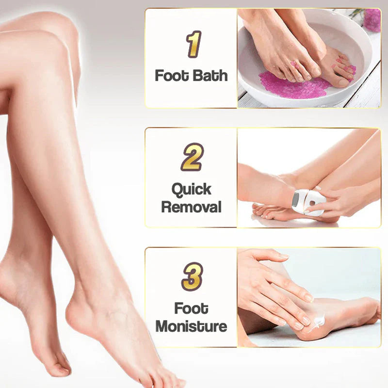 Gleam™ – Élimination douce des callosités pour des pieds lisses et soyeux [50 % de réduction]