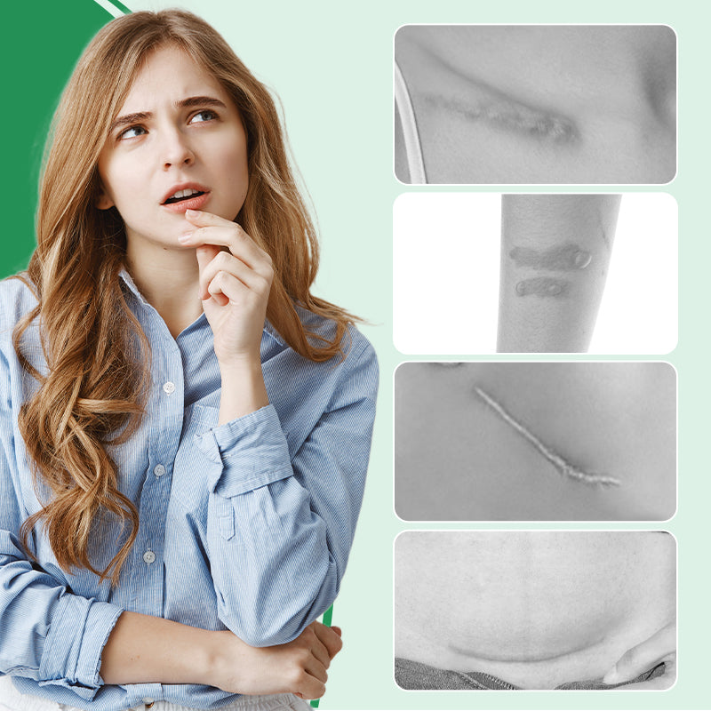 Scarify™ – Pansements en silicone réutilisables pour des cicatrices estompées et une peau impeccable [1 + 1 Gratuit]