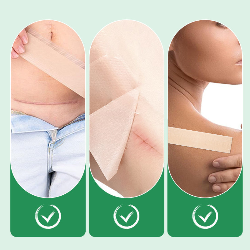 Scarify™ – Pansements en silicone réutilisables pour des cicatrices estompées et une peau impeccable [1 + 1 Gratuit]
