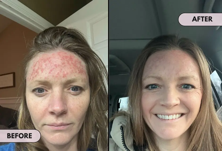 GlowGuard™ – CC crème teintée avec SPF 43 pour une peau éclatante [1 + 2 Gratuit]