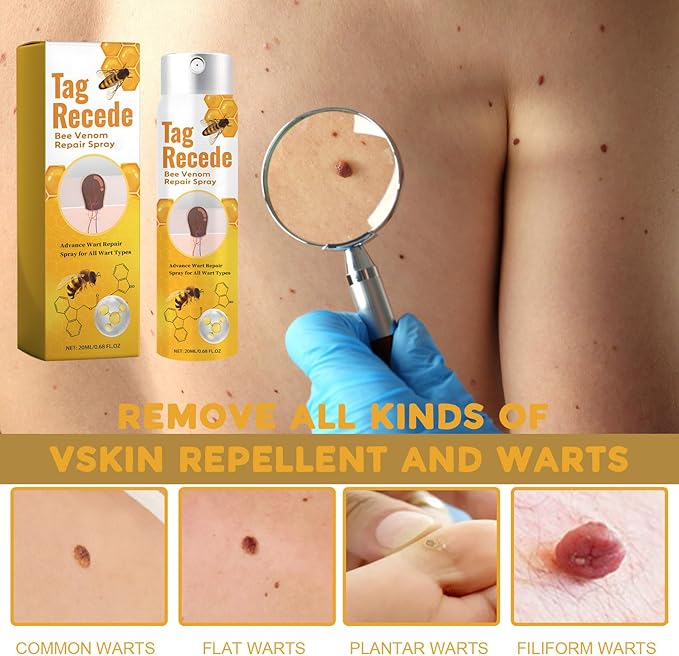 Soin Ciblé Verrues et Acrochordons – Formule Végétale Douce