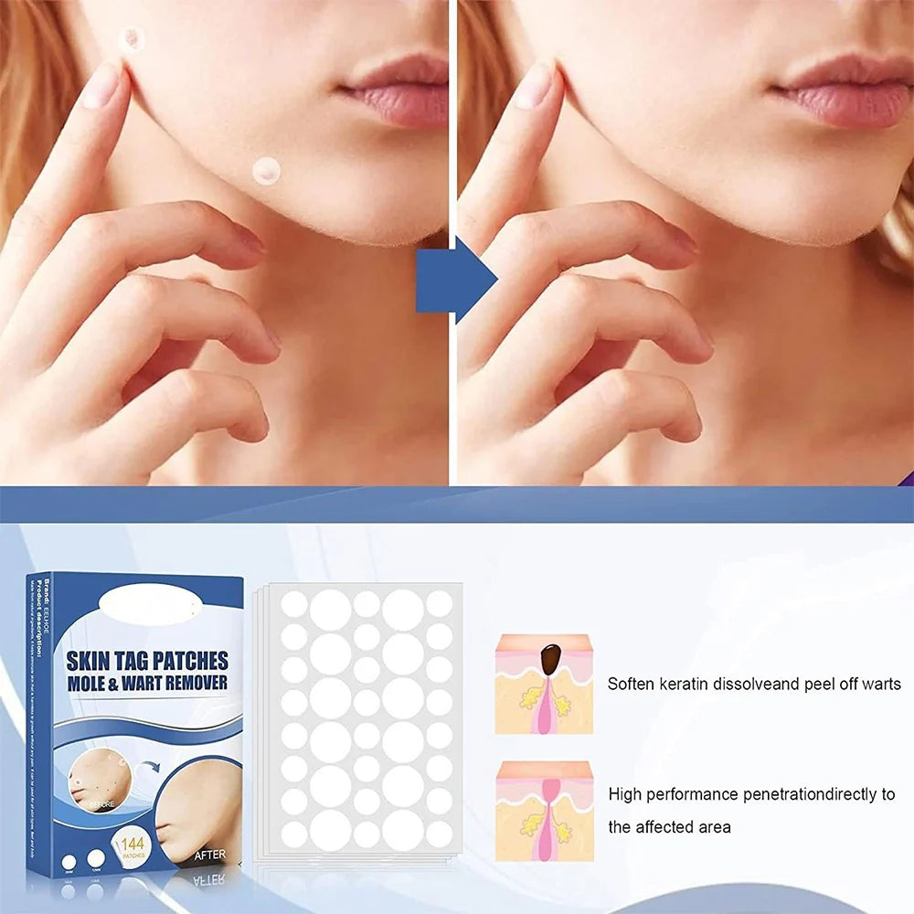 PatchAway™ – Éliminez les lambeaux de peau sans douleur et sans effort [50 % de réduction]