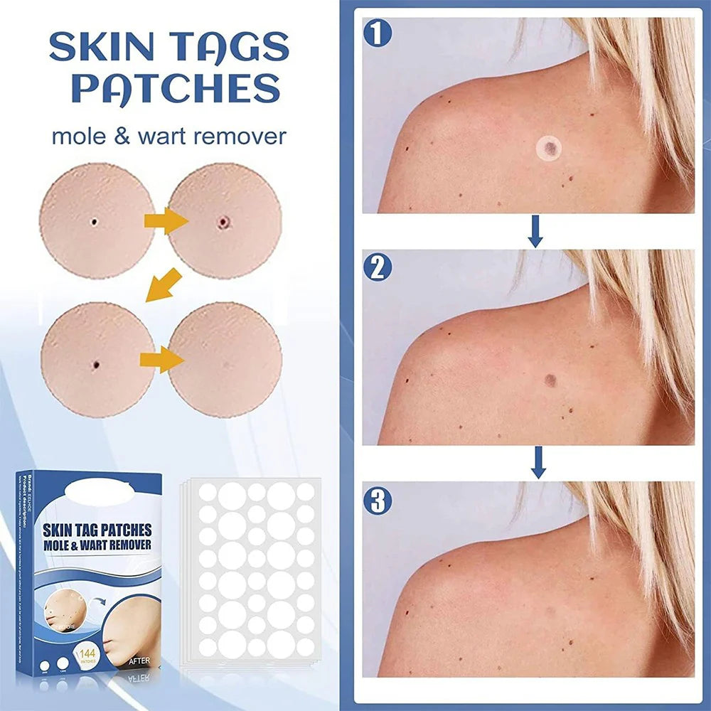SkinPatch™ – Traitement indolore et non invasif pour une peau visiblement claire et saine [1 + 1 Gratuit]