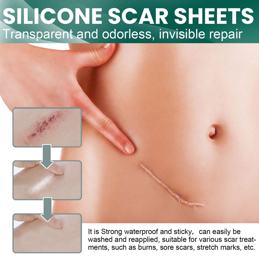 Dermiva™ – Bandes en silicone pour cicatrices efficaces [1 + 1 Gratuit]