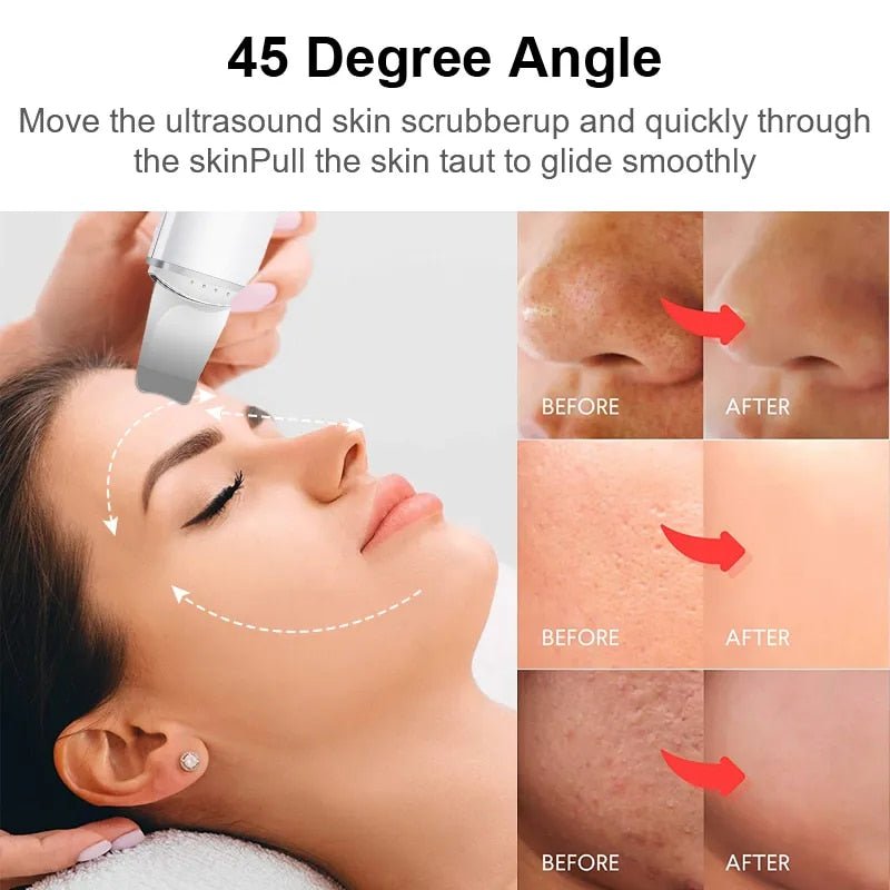 SkinElixir™ - Découvrez une beauté sans défaut [50% de réduction]
